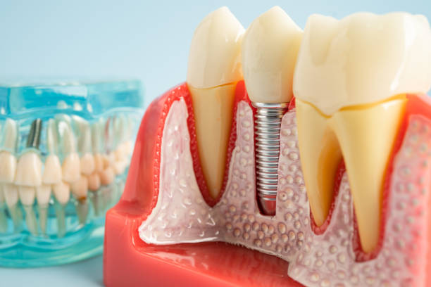 Best Emergency Dental Care  in Davie, FL